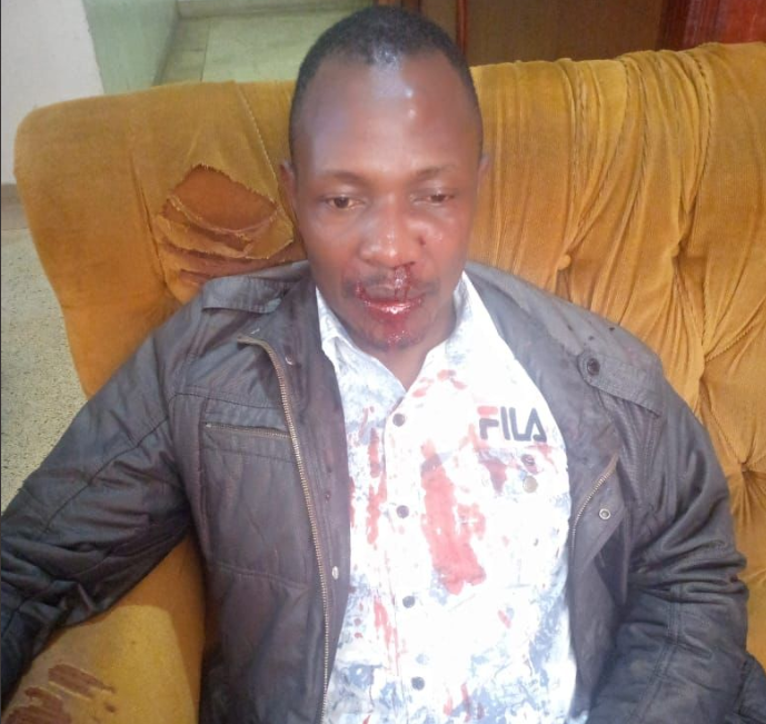 Suspected Thief Shot And Wounded Outside Parliament, Nairobi