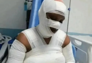Artist Rachael Wandeto Who Was Attacked And Burnt With Petrol For Succumbs To Injuries In Hospital